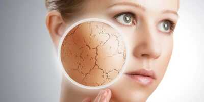 Сухая кожа, причины и лечение: как избавиться от сухости кожи
